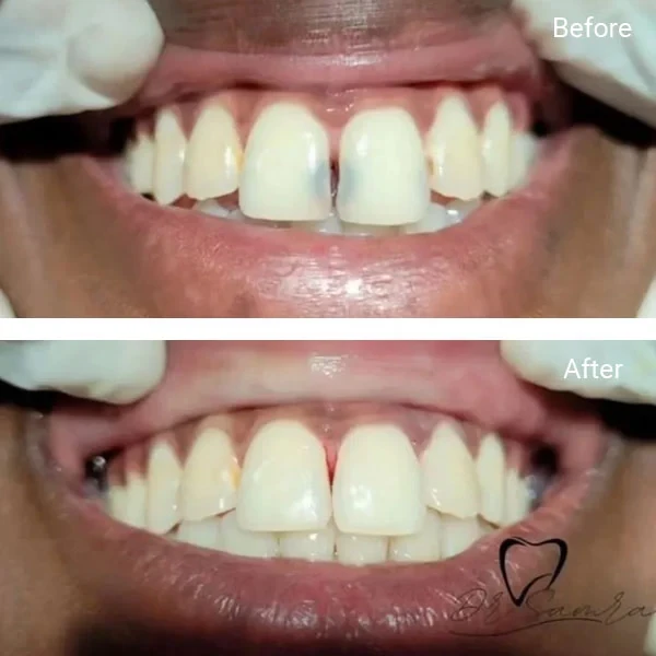 Smile gallery 2: original before-and-after dental photographs from Legacy Care