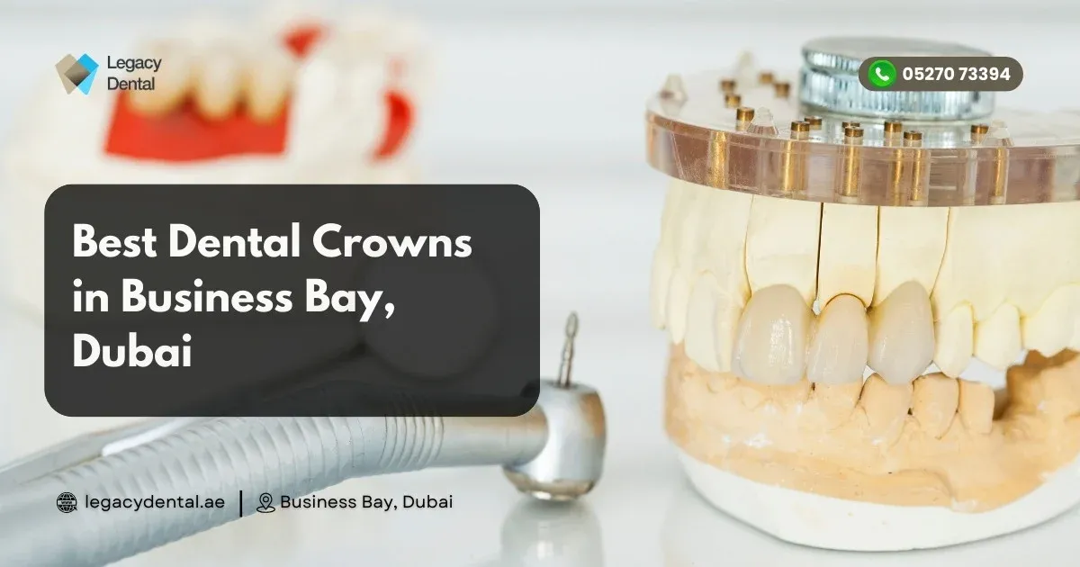 Best Dental Crowns in Business Bay, Dubai
