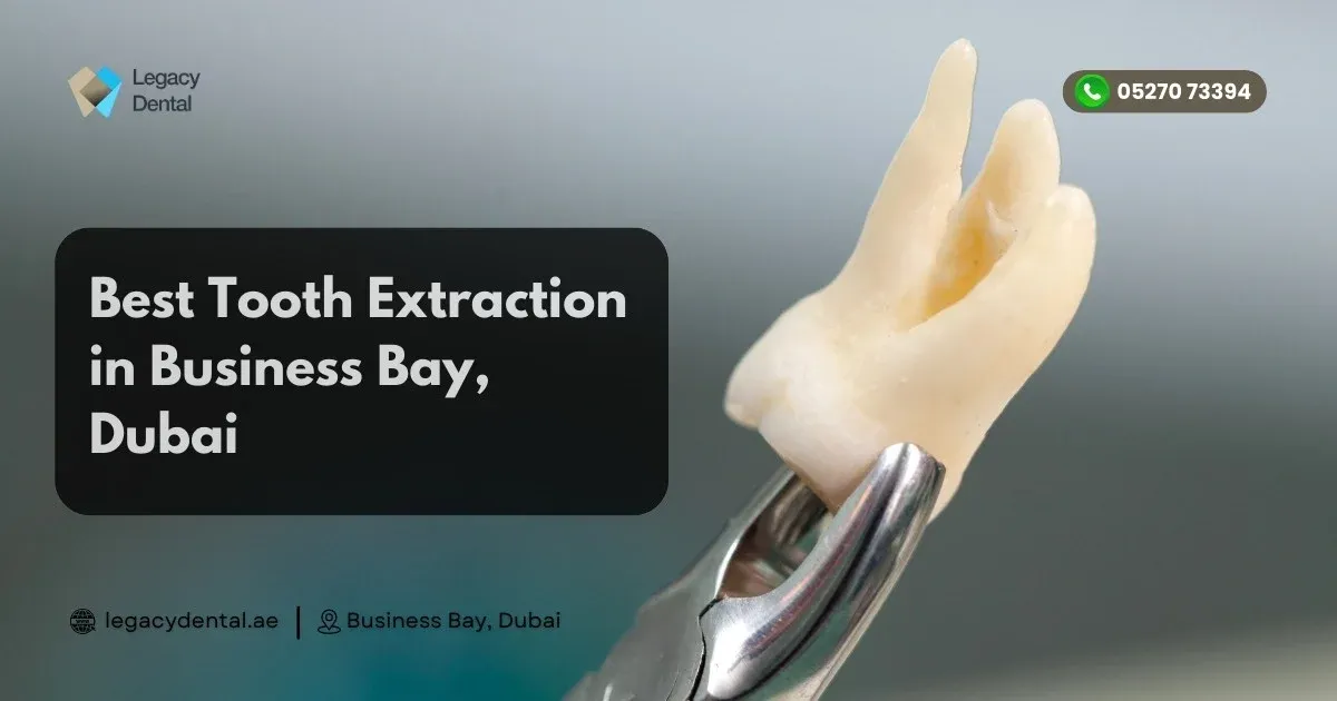 Best Tooth Extraction in Business Bay, Dubai