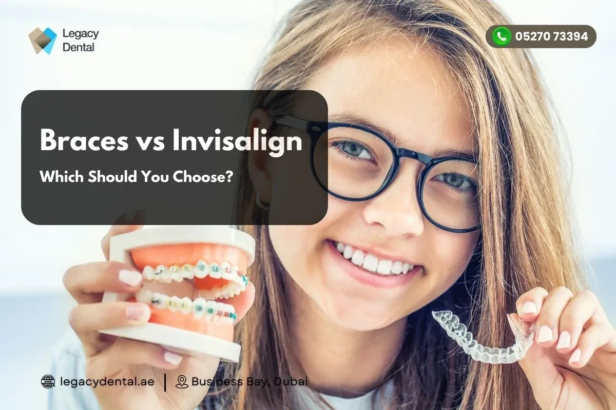 Metal Braces vs. Invisalign: Which Should You Choose?