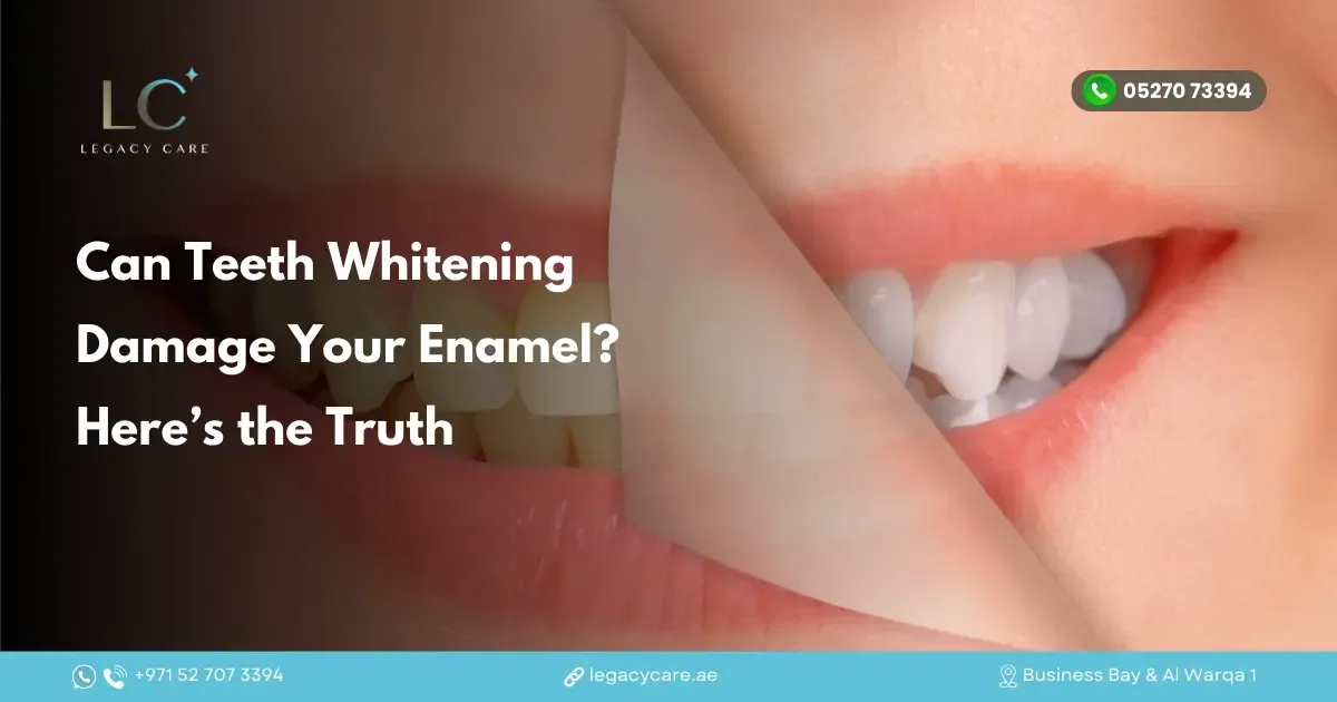 Can Teeth Whitening Damage Your Enamel? Here’s the Truth
