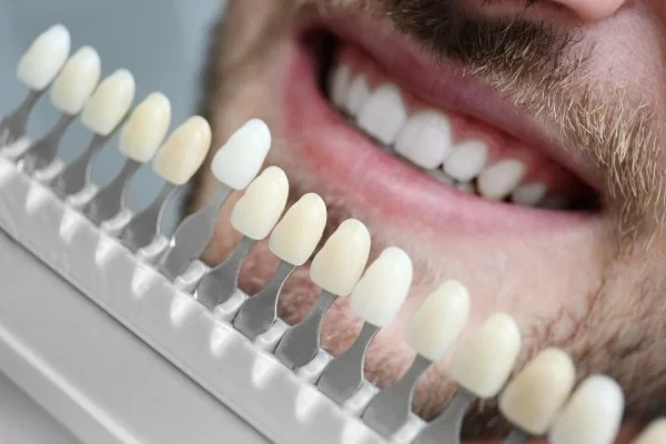 Comparing tooth shades with a patient