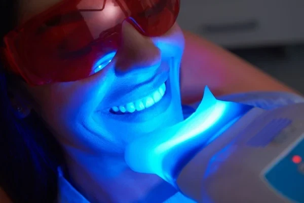 A patient receiving light-assisted teeth whitening