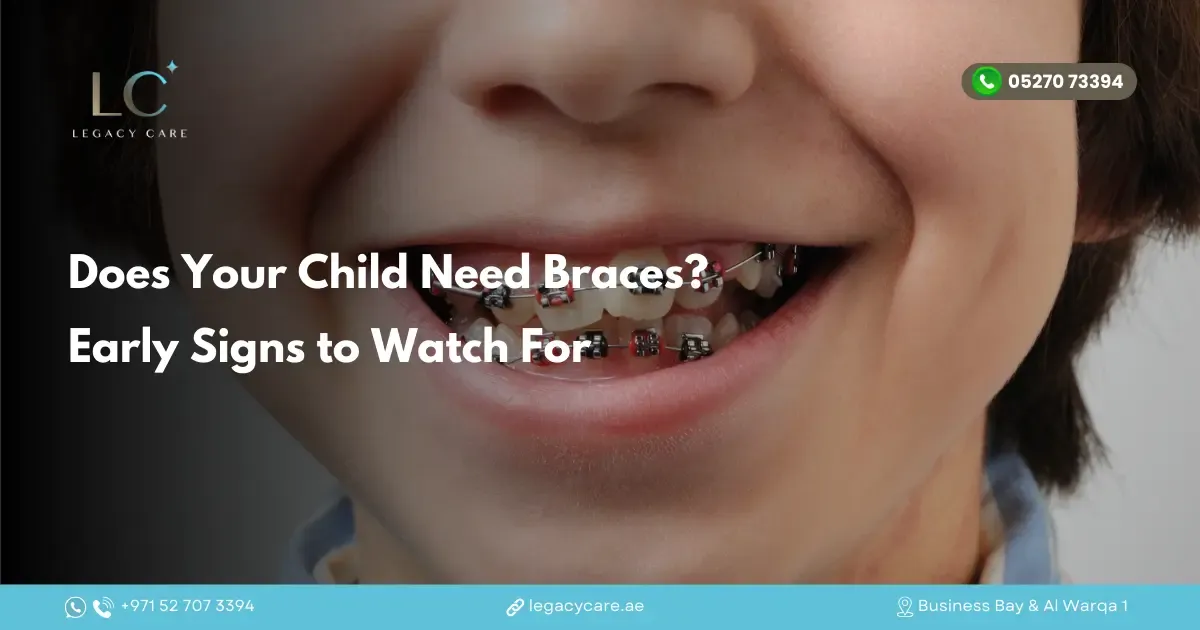 Does Your Child Need Braces? Early Signs to Watch For