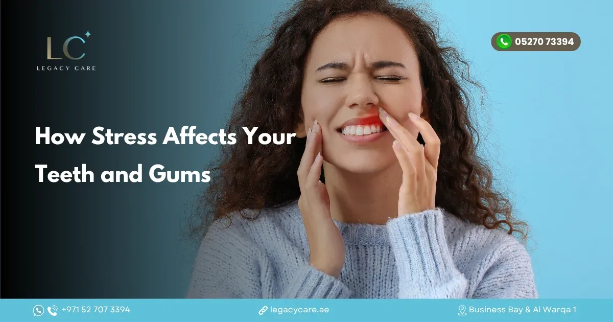 How Stress Affects Your Teeth and Gums
