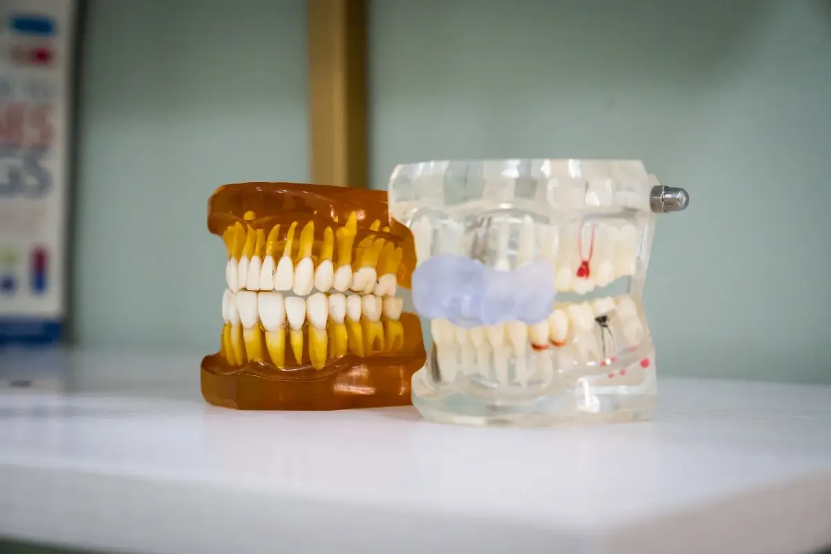 Dental models used to explain oral health
