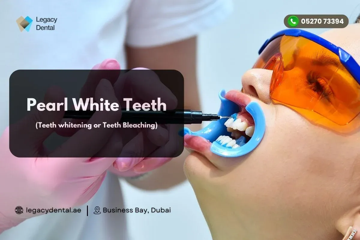 Pearl White Teeth