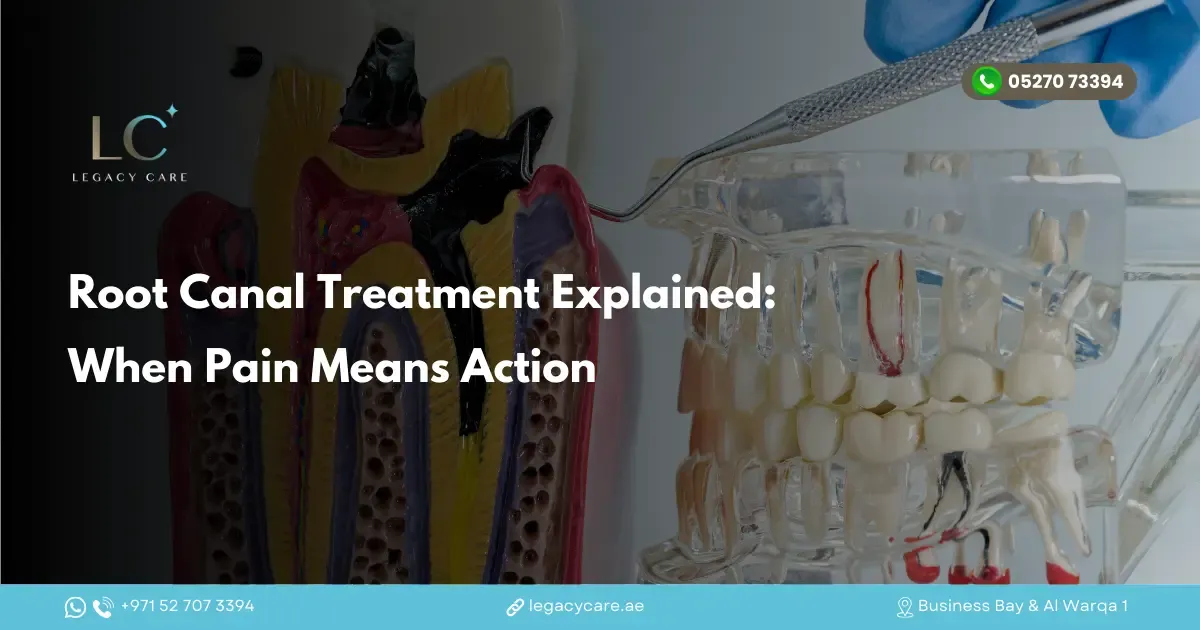Root Canal Treatment Explained: When Pain Means Action
