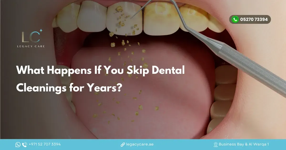 What Happens If You Skip Dental Cleanings for Years?