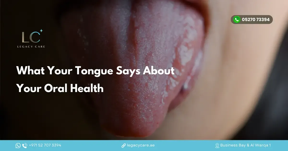What Your Tongue Says About Your Oral Health