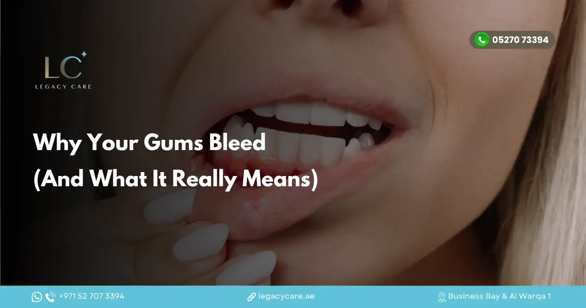 Why Your Gums Bleed (And What It Really Means)