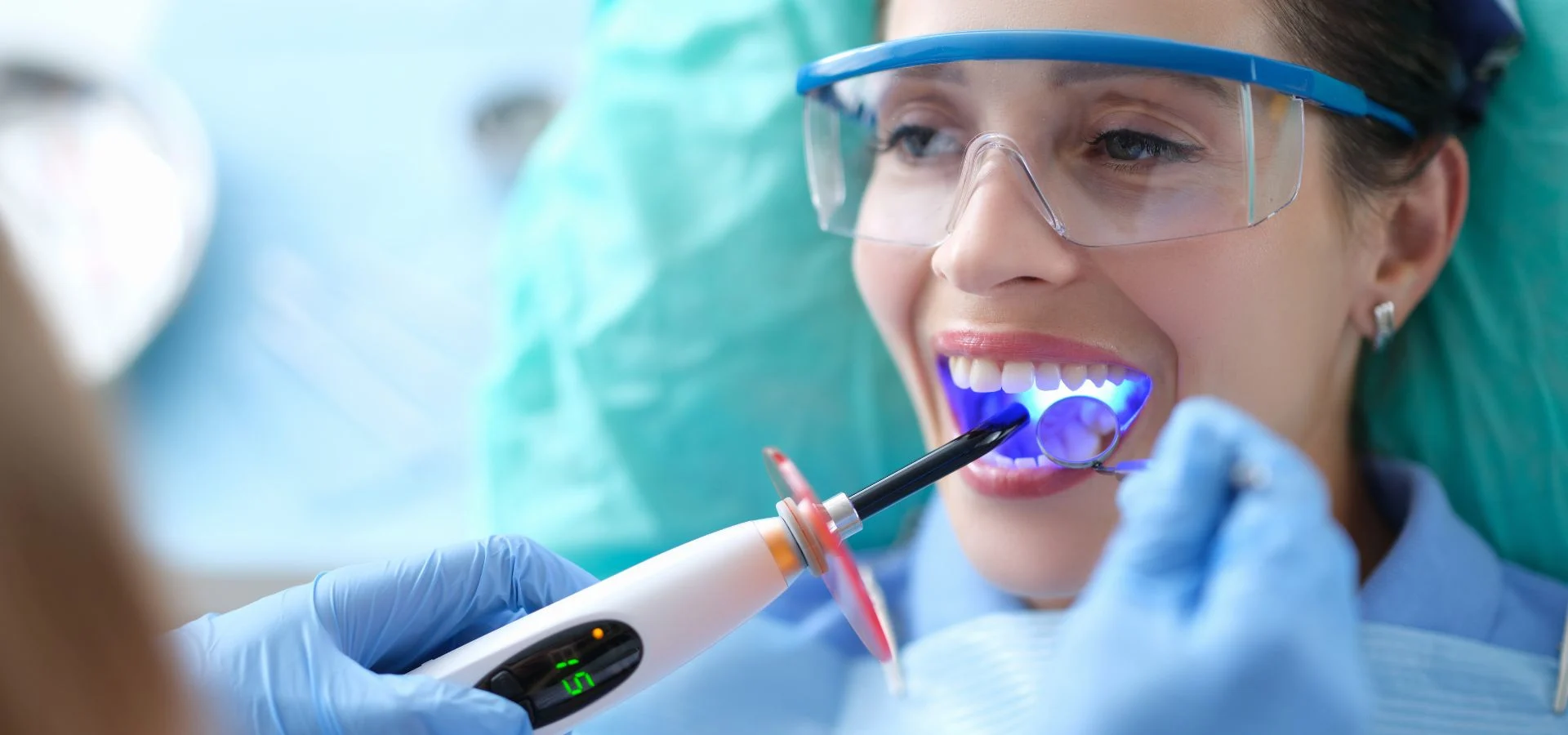 Tooth-Colored Fillings in Dubai