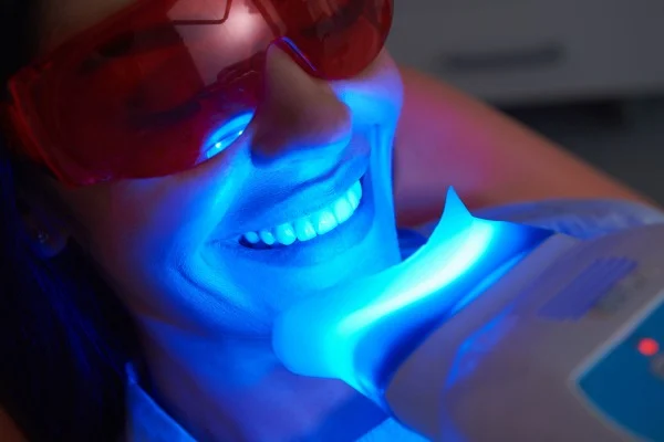 Zoom Whitening in Dubai