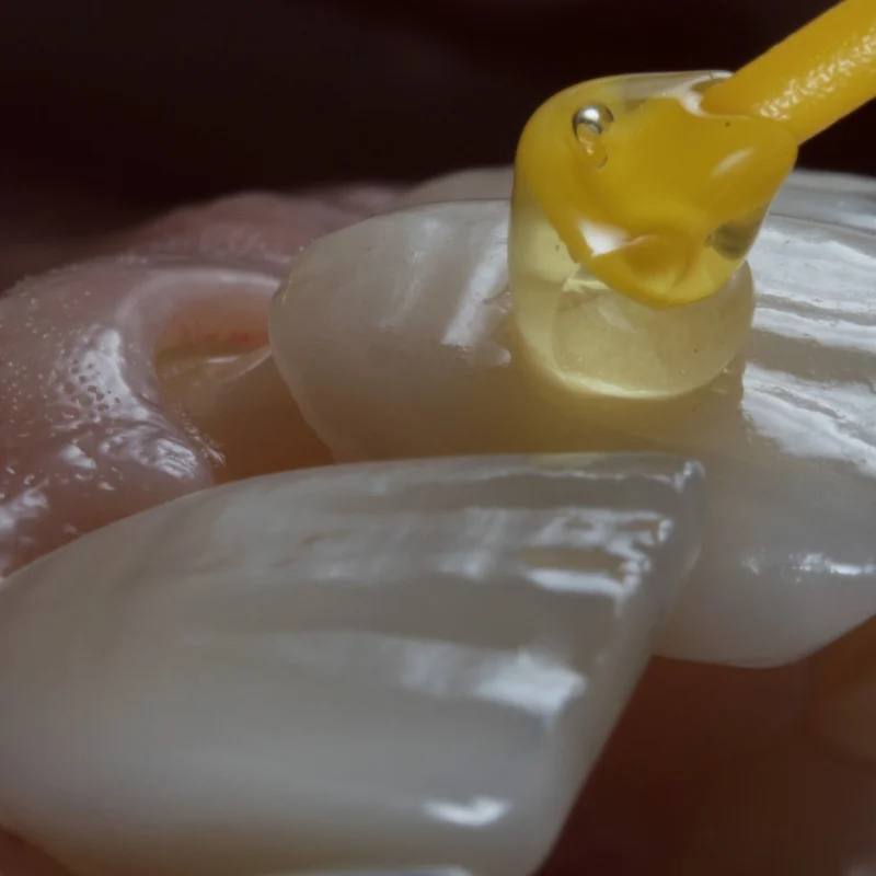 No-Prep Veneers in Dubai