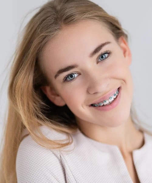 Retainers (Fixed & Removable) in Dubai