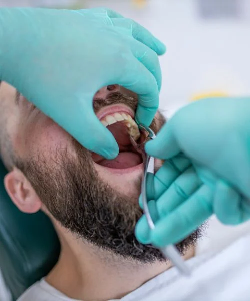 Wisdom Tooth Extraction in Dubai